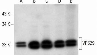 图片[1]-vps29(Vps29抗体)-百变无痕