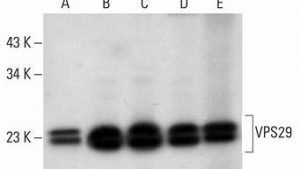 vps29(Vps29抗体)-百变无痕