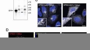 vps51(vps518)-百变无痕