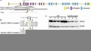 vps16(基因导致的肌张力障碍)-百变无痕