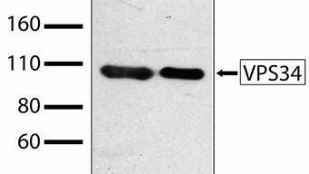 重组vps34蛋白(重组蛋白表达)-百变无痕